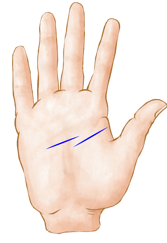 Interrompida